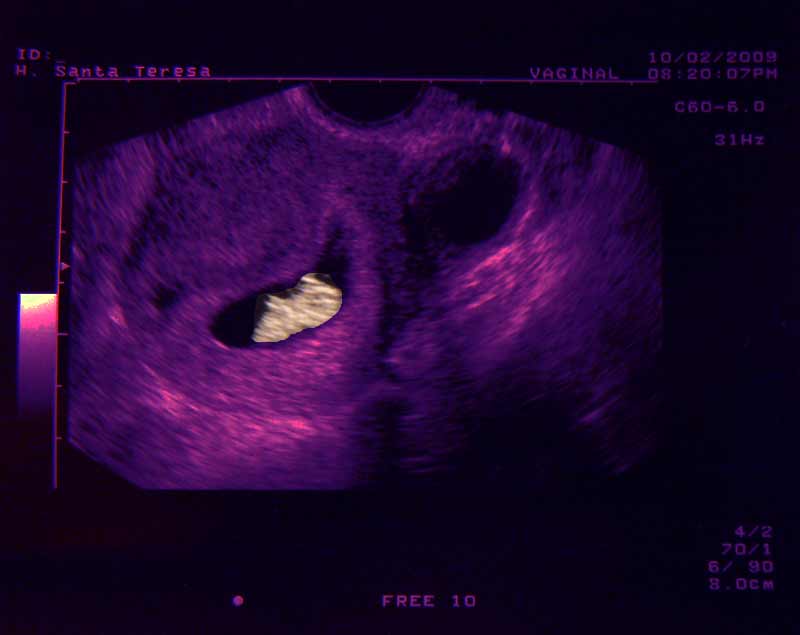 8semanas-solucion 8semanas-solucion
