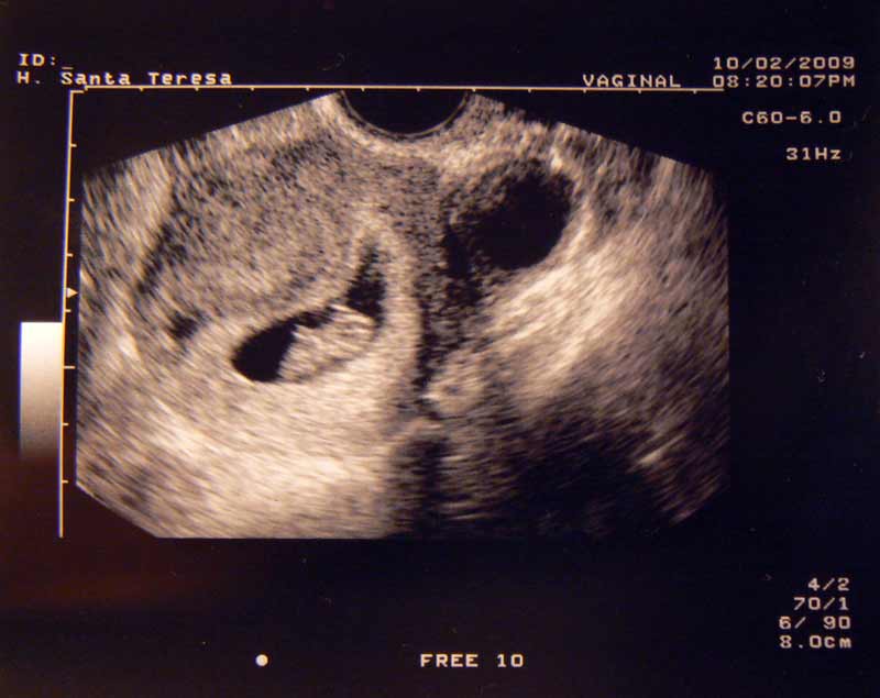8semanas 8semanas